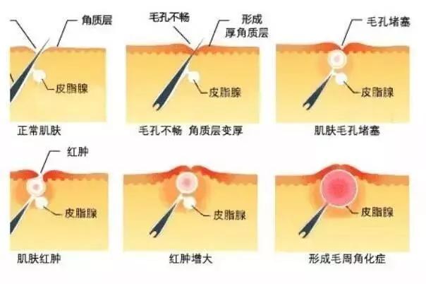 get何穗同款牛奶肌！秋冬去鸡皮，黑黄皮必入