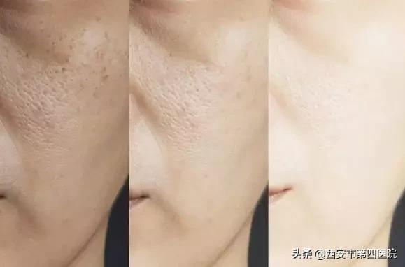 安心变美下巴整形,安心变美课堂