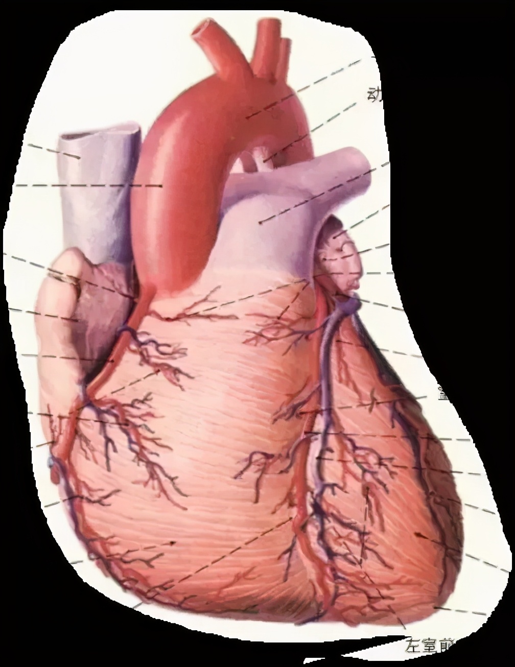 心包积液1.0厘米严重吗,心包积液引流了1000多毫升