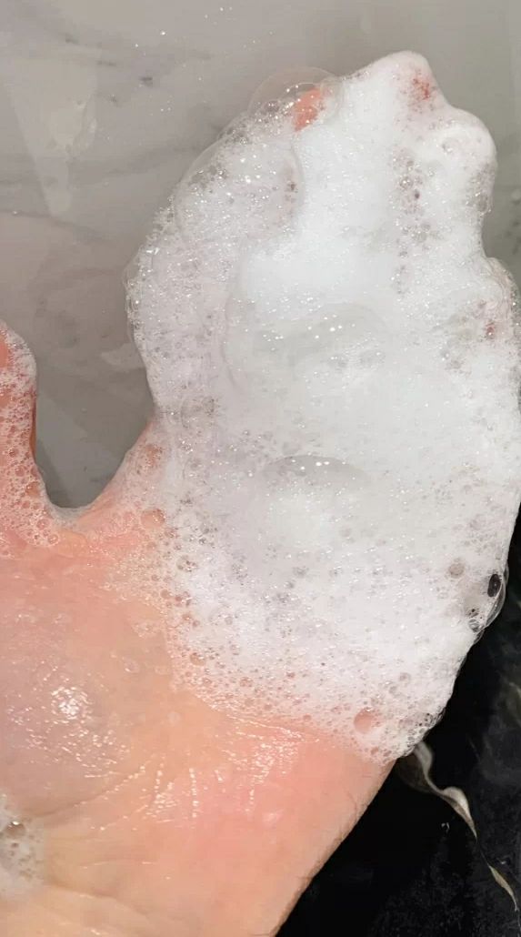 鼻子黑头去除后怎么收缩毛孔,鼻头黑头收缩毛孔用什么