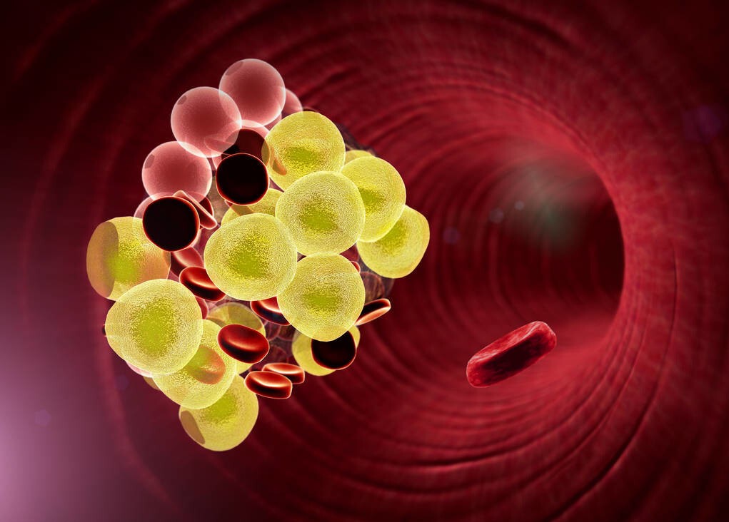 房颤血栓和斑块破裂的血栓一样吗,房颤时预防动脉血栓最有效的药物