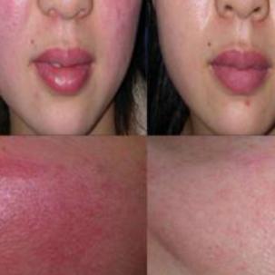 小玛直播公益课,小玛公益课堂