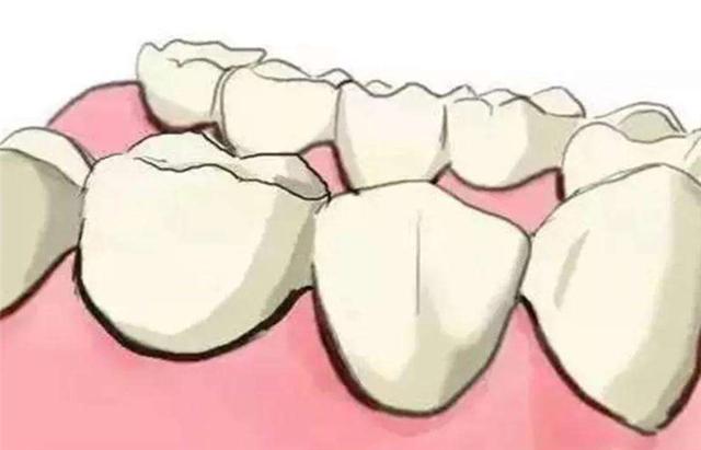 牙齿上有黑色斑点刷也刷不掉,牙齿上有黑线但是不痛