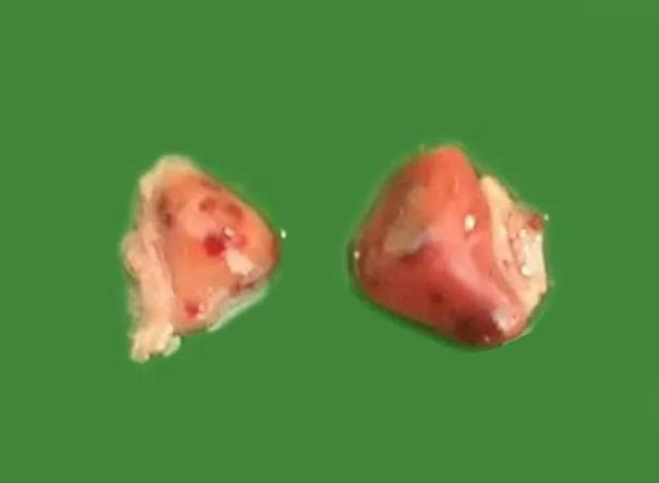 慢性鸭肝炎,每天零星伤亡鸭子,很烦人怎么办?