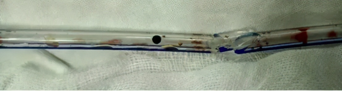 放置引流条的注意事项,引流管需要每天拔出更换新的吗