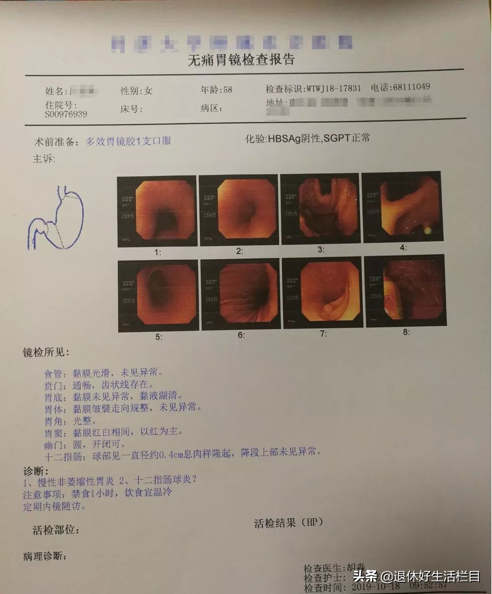 胃疼胃胀胃不舒服偏方,胃痛胃胀不消化是哪种胃炎