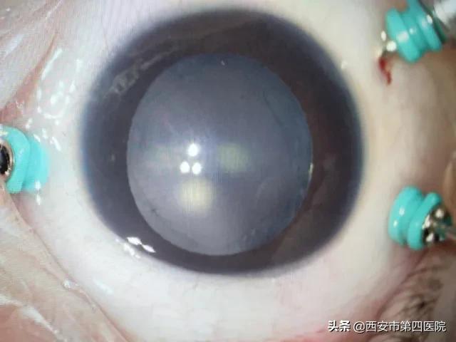 硬核技术试验成功了吗,硬核技术