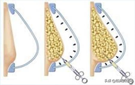 最简单的丰胸训练方法,平胸丰胸最有效的方法