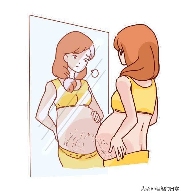 生过孩子的人，身体会有这5个特征，快来看看准不准