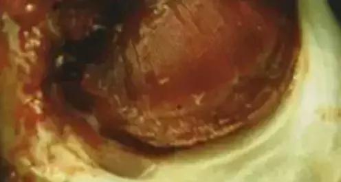 鱼类寄生虫有哪些,鱼类寄生虫的科普知识