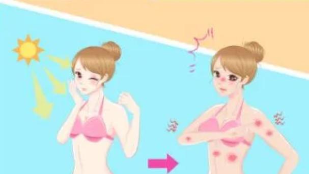 紫外线治疗白癜风会发黑发红吗,白癜风患者怎样预防紫外线