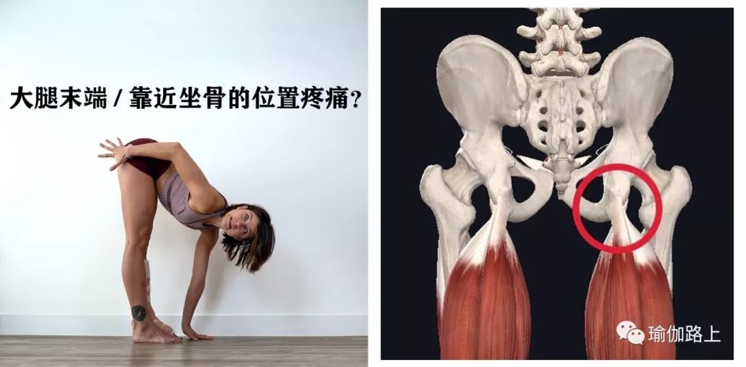 练瑜伽大腿后侧拉伤如何快速恢复,练瑜伽屁股根痛是拉伤了吗怎么办