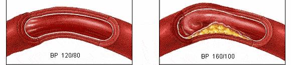 这7个办法让你的血管更强大,血管阻塞教你一招通血管的方法