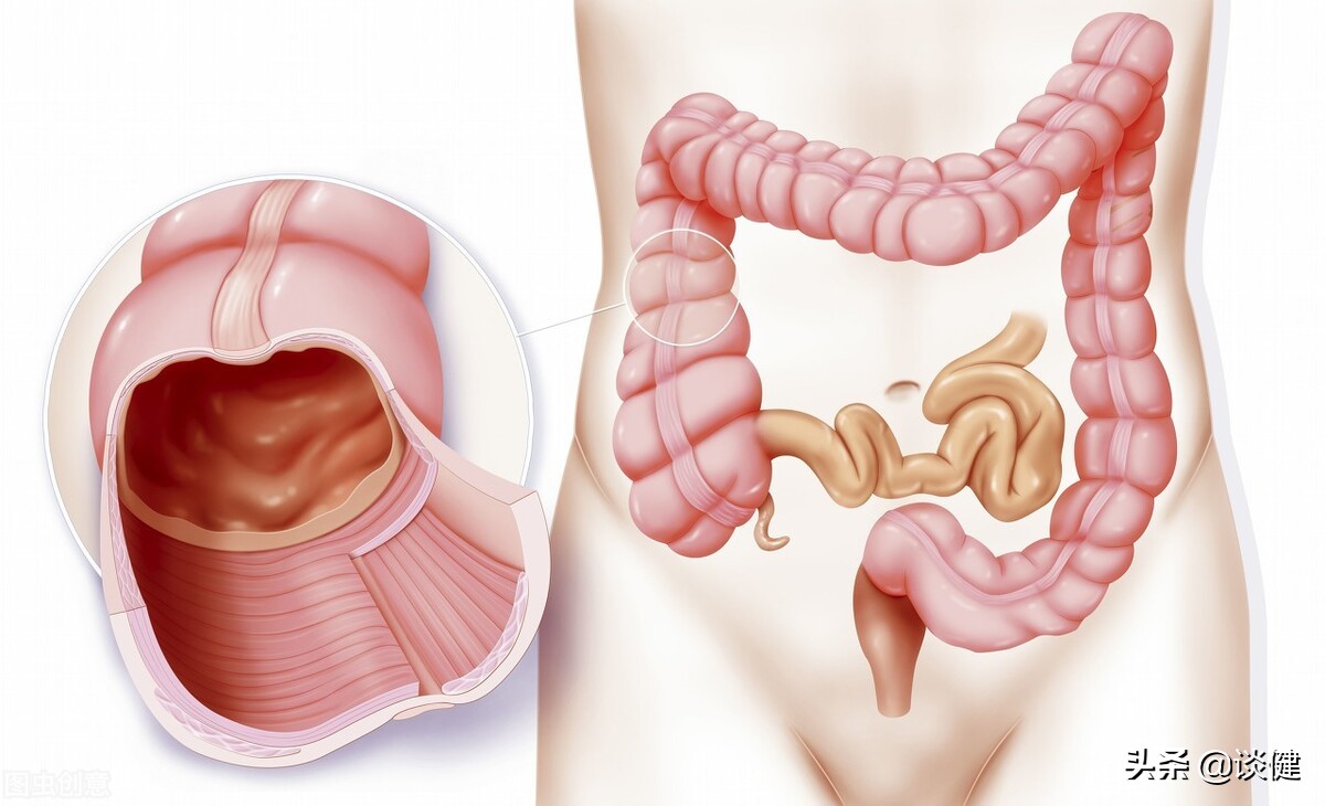 害怕胃肠镜,如何避免肠镜并发症