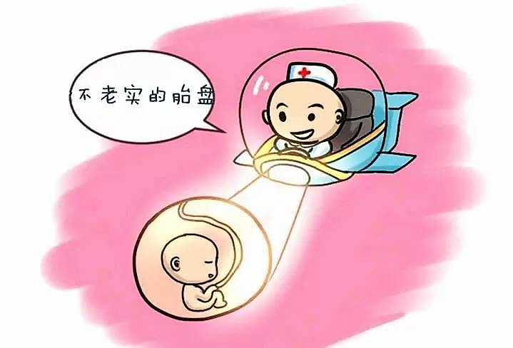 前置胎盘的主要护理诊断是什么,前置胎盘剖腹产要几个医生