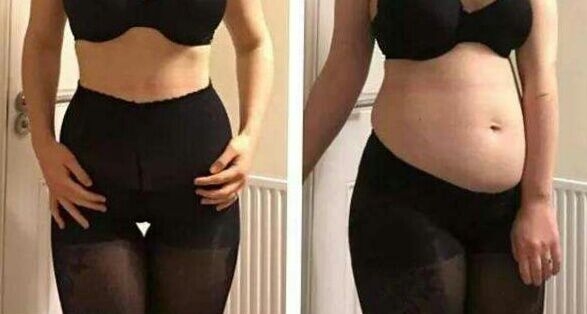 塑形需要天天练吗,练塑形大概要多久