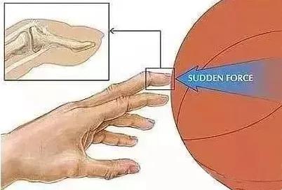 打球吃萝卜正确处理方法,打球时吃萝卜丁怎么处理