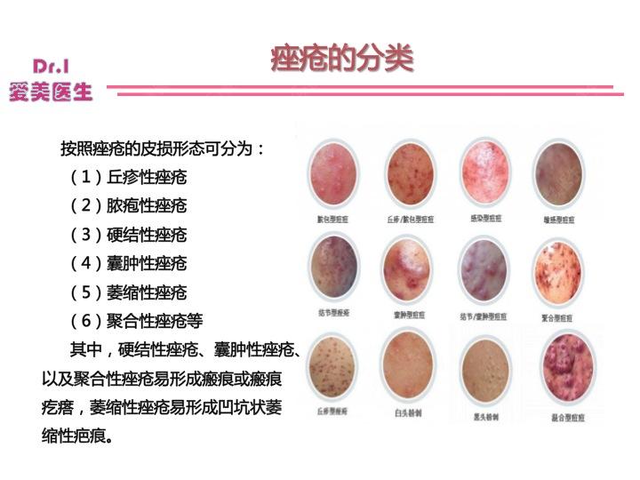 脾胃湿热引起的痘痘用什么,湿热生疮多吃什么才好