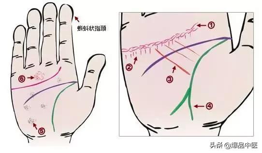 手诊图大全清晰图手背,全息手诊图