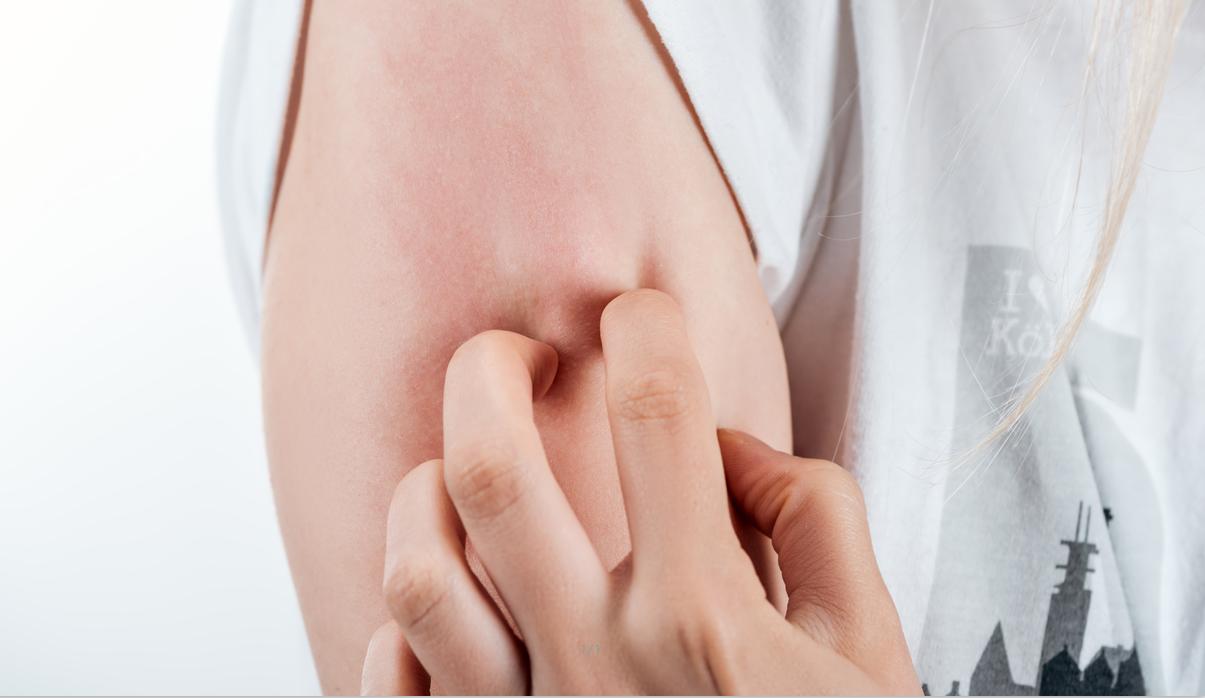 自己治疗鱼鳞病，这三种“网红法”有钱有闲的再来尝试