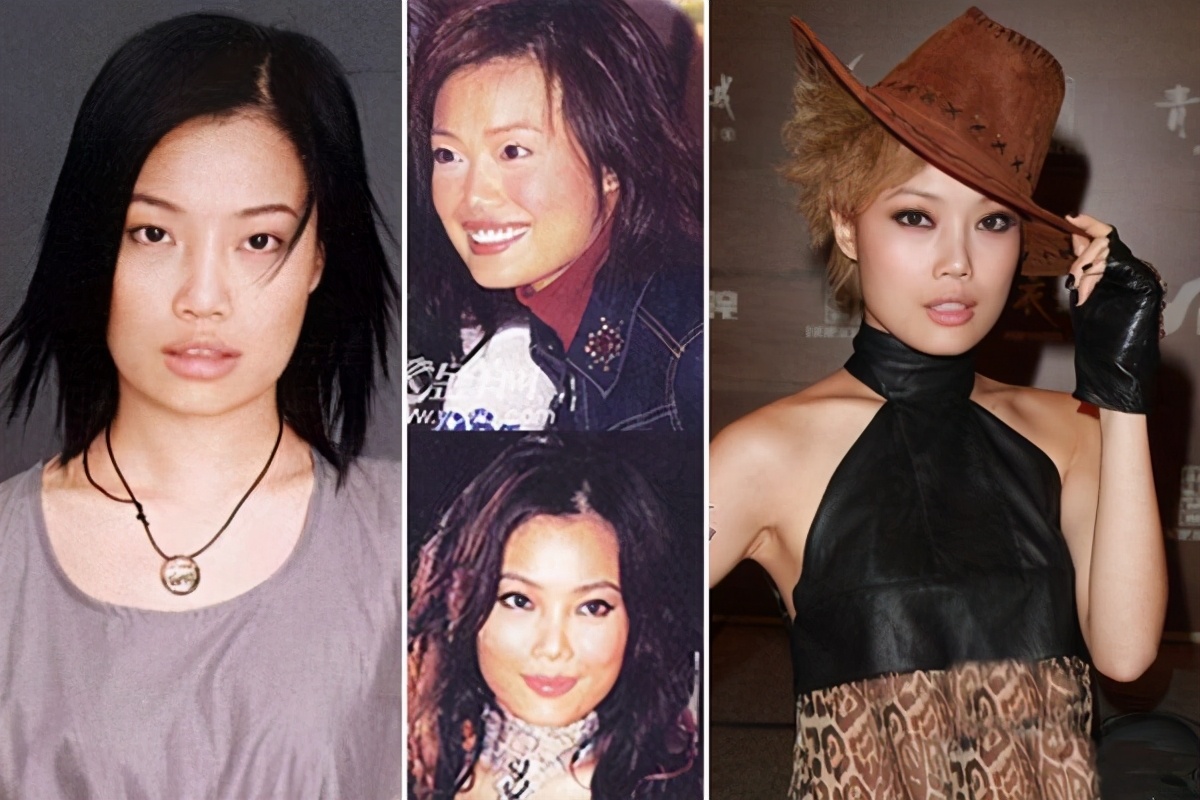 隆鼻对皮肤有什么影响,隆鼻对颜值有多大影响