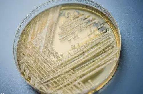 超级真菌致死率高达60%,致死率高达60%的超级真菌