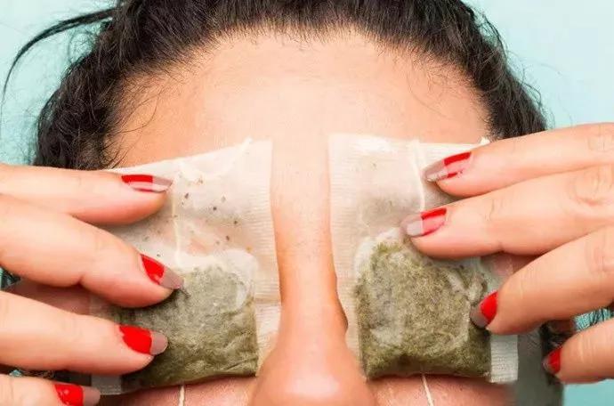 长期黑眼圈小心是这5种疾病,常有黑眼圈警惕四种病