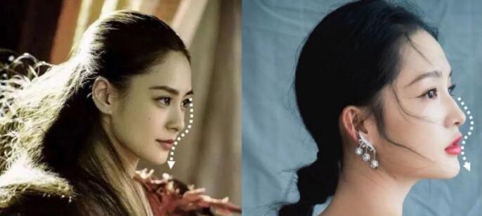 面部一枝花全靠鼻当家，论鼻子对颜值的重要性▼