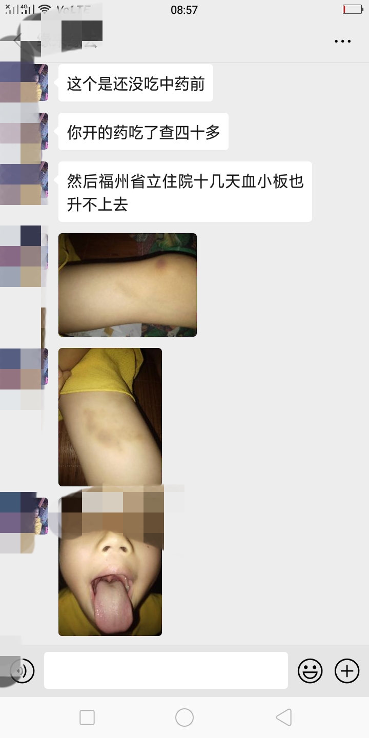 血小板减少性紫癜用什么中药调理,中药治疗血小板减少症药方