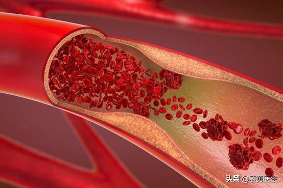 年过60岁，如何拥有健康和谐*生活性**，医生告诉你60后*生活性**指南