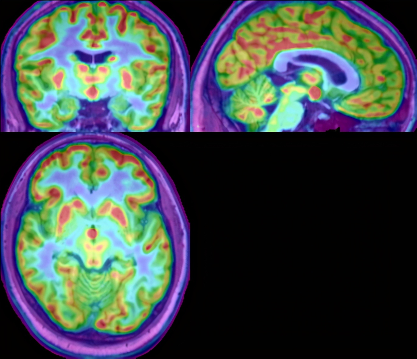 哈医大二院机器人,哈医大二院机器人手术