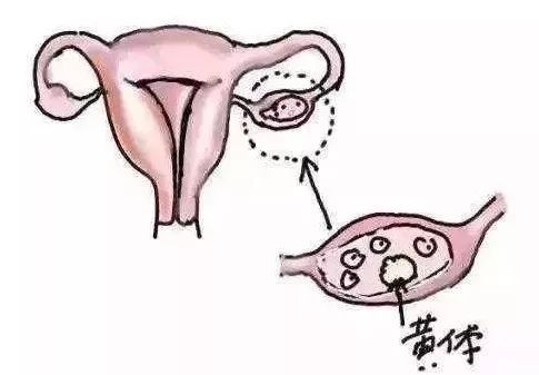 有妇科炎症的女生平时该注意什么,去检查妇科最佳时间段要注意哪些