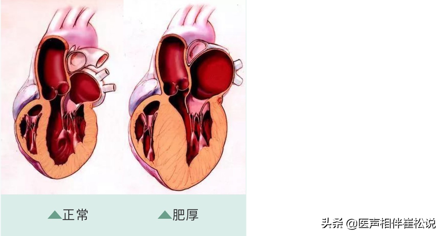 这份心脏说明书请收好,心脏保健手册