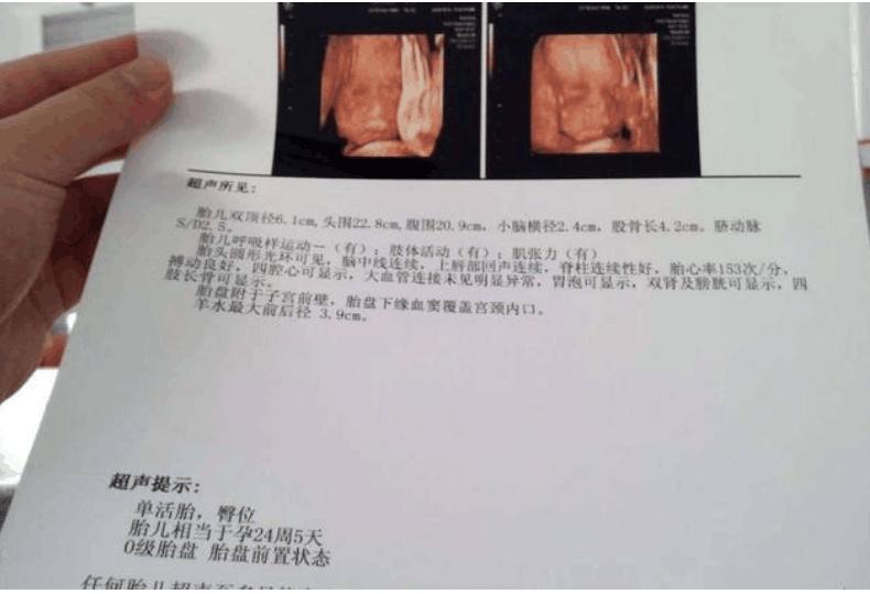 怕胎儿畸形应做哪些检查,怕胎儿有问题还可以做什么检查