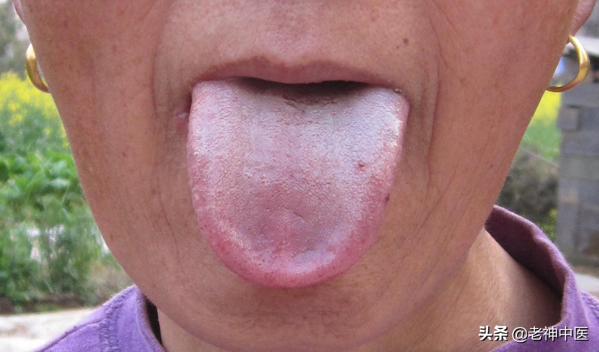 二型糖尿病脚有针刺感吃什么药,糖尿病脚有针刺的感觉是怎么回事