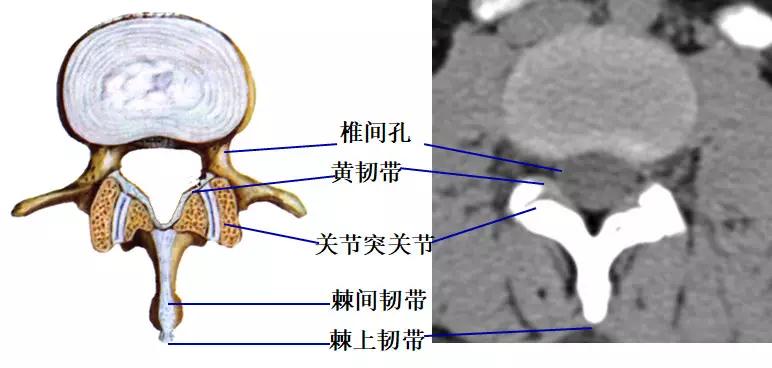 颈椎腰椎疾病ct及mri诊断,腰椎ct可以发现肠部病变吗