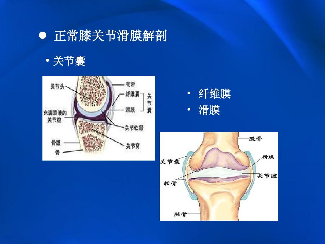 膝关节结核，是由结核杆菌引起的，主要临床表现是单侧关节发病