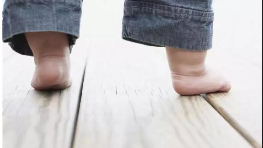 有效预防拇指外翻和扁平足,为了预防扁平足我们要穿什么鞋
