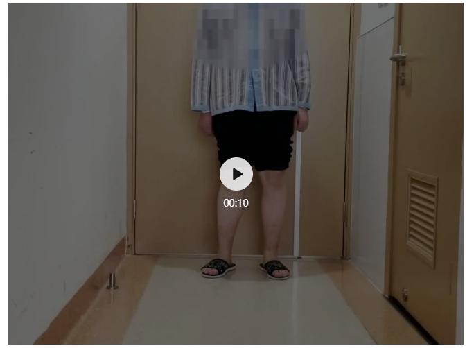 骨盆倾斜导致长短腿严重会怎样,长短腿骨盆倾斜