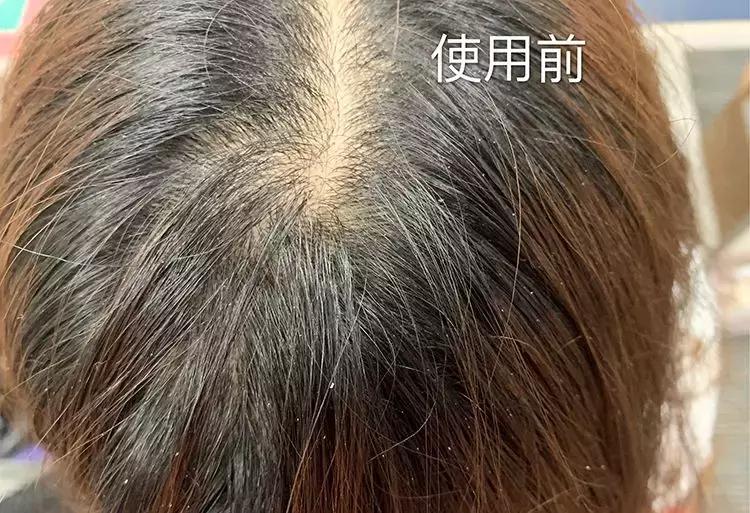 适合清扬的樱花洗发水,明星都在推荐洗发水止痒控油