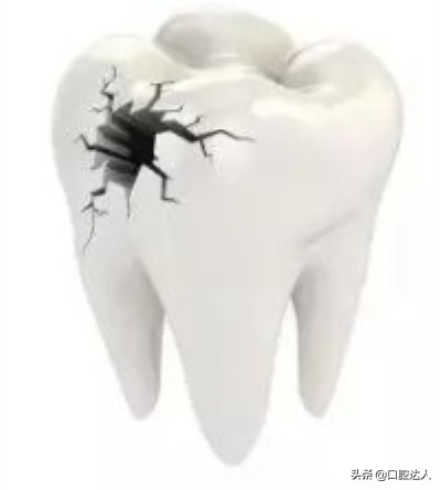 崩溃吃饺子,过年吃饺子硬币崩掉牙