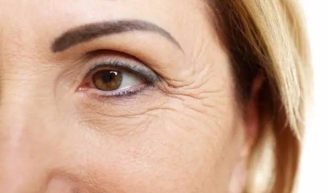 去鱼尾纹最简单的方法是哪种,名门泽佳怎么去黑眼圈