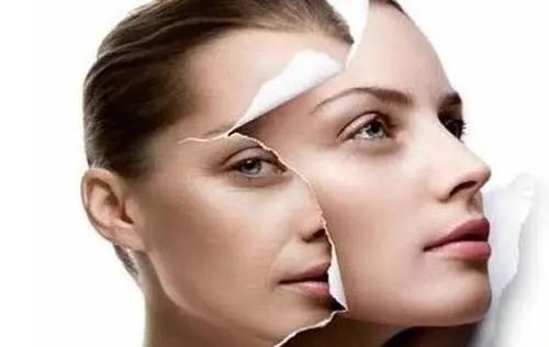 科普时间到:医美“神器”Dysport吉适肉毒素,术后注意事项大全