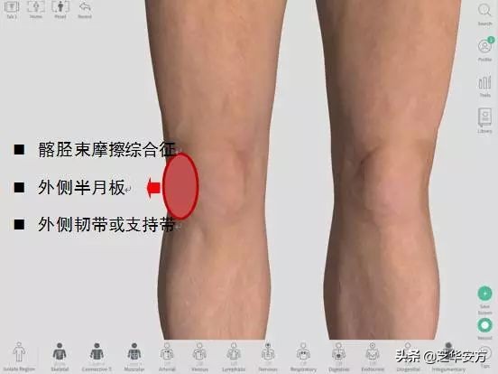 跑姿不对造成的膝盖疼多久能好,膝盖不同位置疼痛代表什么