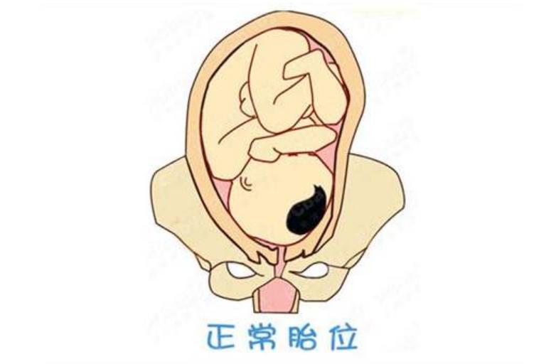 关于顺产，疼一下子还是疼几天，由6个因素决定，想顺产要多了解