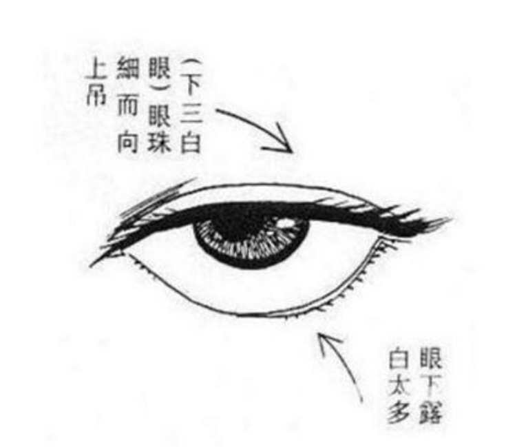下三白眼长大后会改善吗,下三白眼的人如何手术矫正