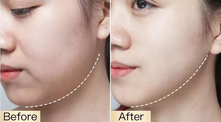 影后强势打Call！1片去浮肿、3周变紧致，大饼脸也有救了