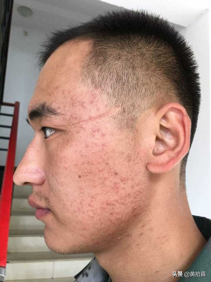 一个很丑的男生怎么改变自己,一个丑男人怎么变帅