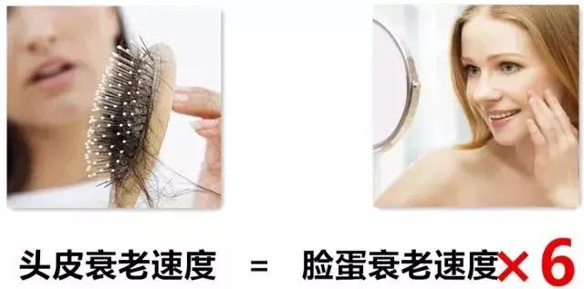 头油头皮屑多脱发洗发水,头油头皮屑多洗发水推荐