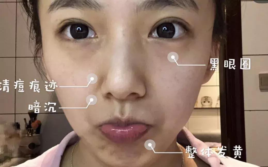 一到晚上皮肤暗沉发黄,一到下午皮肤暗沉